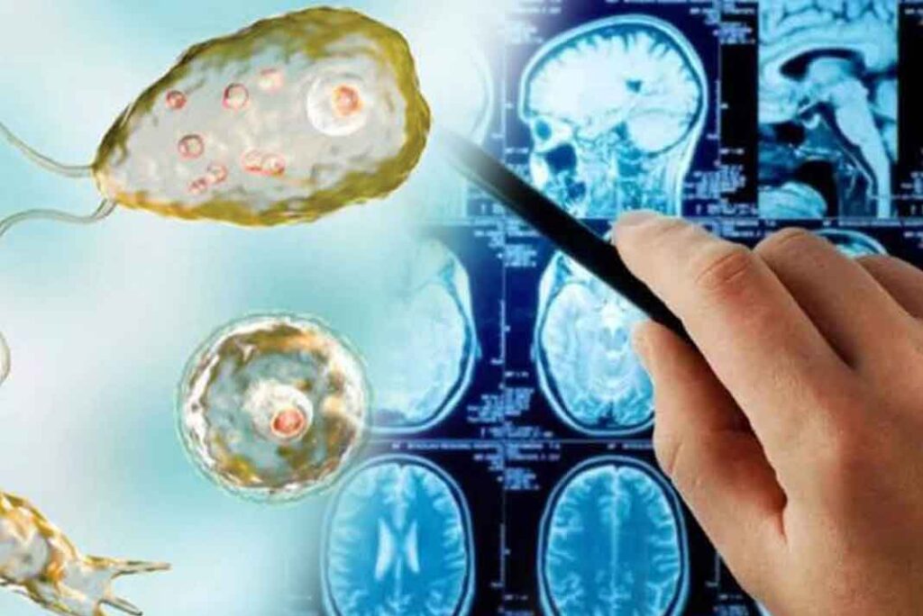 amebacomecerebros962