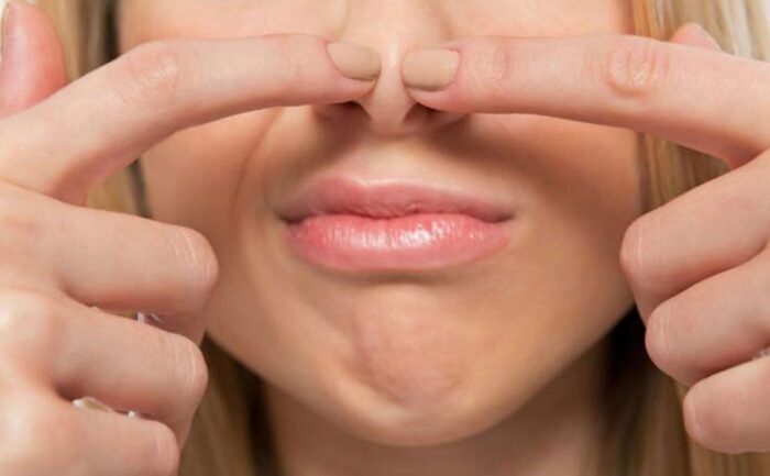 como-quitar-puntos-negros-1-1024x633