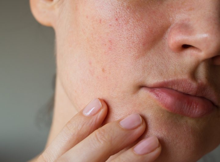 pores on the skin of the face. Cleansing the face skin